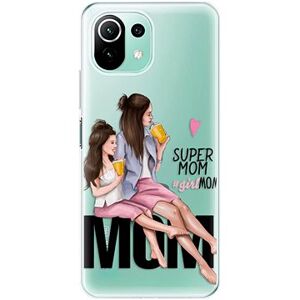 iSaprio Milk Shake – Brunette pre Xiaomi Mi 11 Lite